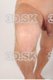 Knee texture of Garry 0002